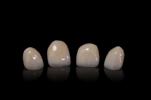 Types Of Dental Crowns: Which One Is Right For You?