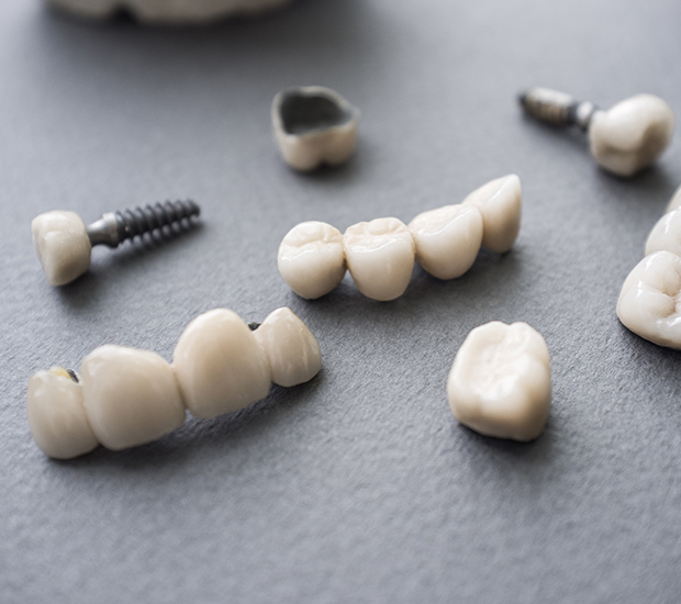 Playa Vista The Difference Between Dental Implants and Mini Dental Implants