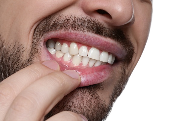 Reasons To Choose Periodontics