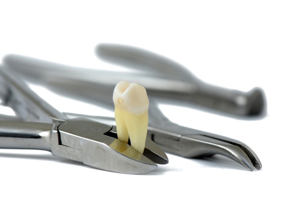 What Age Should I Consider A Wisdom Tooth Extraction?